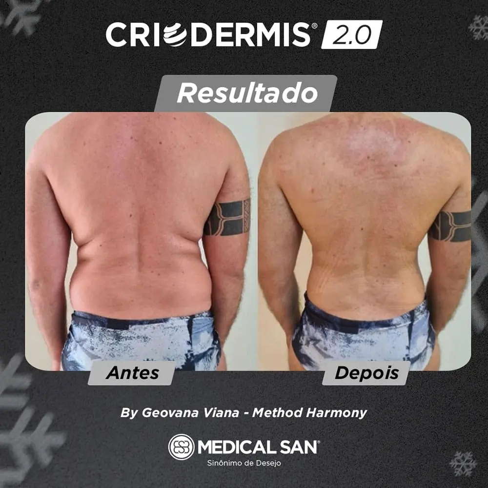 Resultado masculino antes e depois Medical San