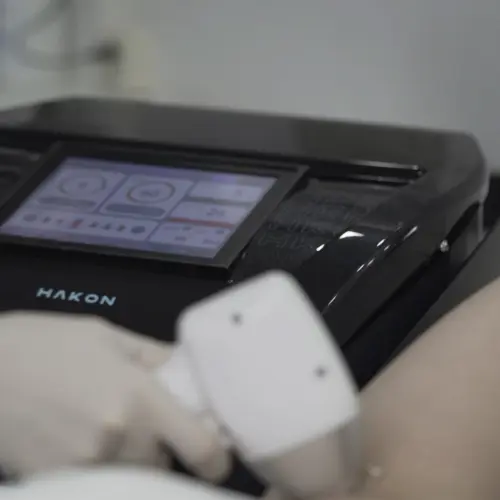 Hakon Laser Para Epilação 4D Premium - Medical San