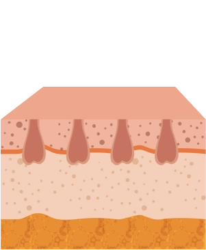 Imagem representando camada de pele com 4 folicolos sem pelos após a sessão a laser